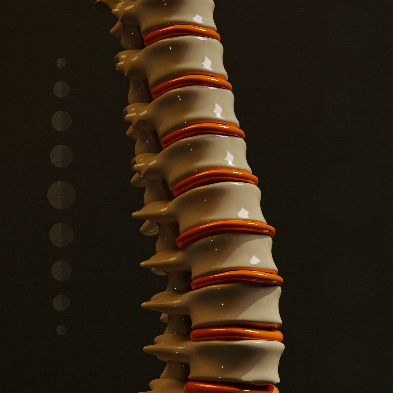 Ilustração de cirurgia de revisão da coluna