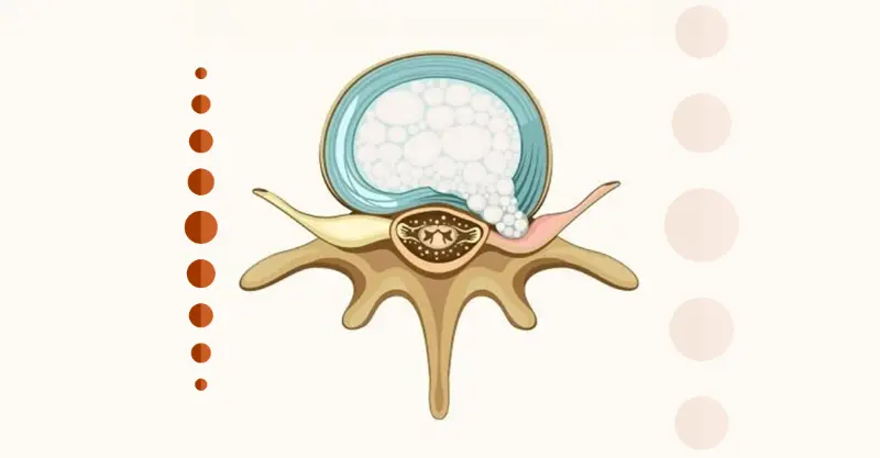 Ilustração anatômica da coluna