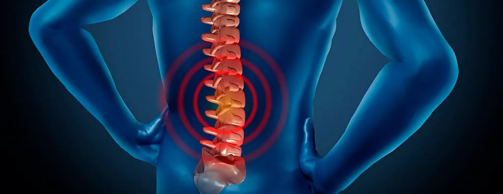 Imagem explicativa: tratamento para dor ciática