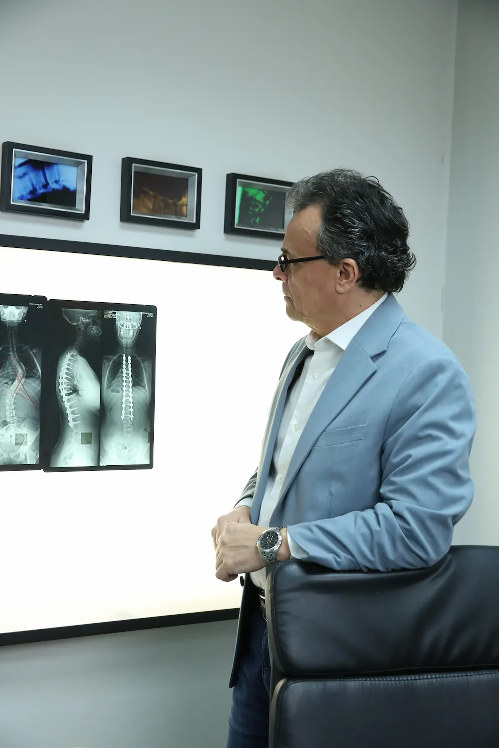 Estenose Foraminal 3D